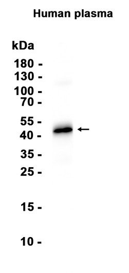 C4 binding protein (YD20429) Rabbit mAb