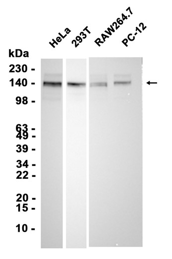 AYD14970