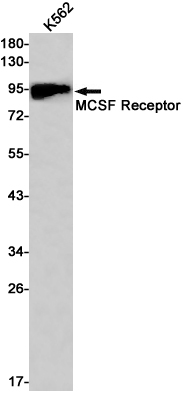 MCSF Receptor (YD20040) Rabbit mAb