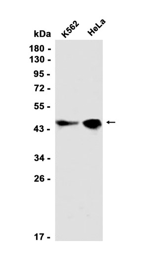 AYD14262