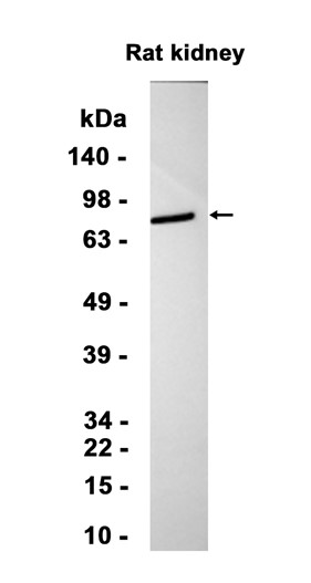 AYD14180