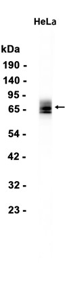 AYD14332