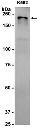 AYD15586