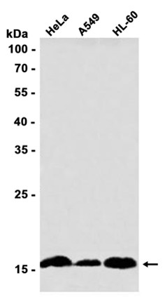AYD11492