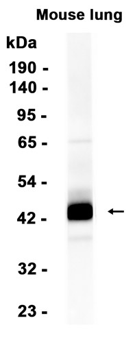 Haptoglobin (YD20940) Rabbit mAb