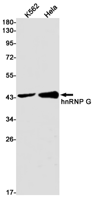 AYD11147