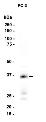 AYD14206