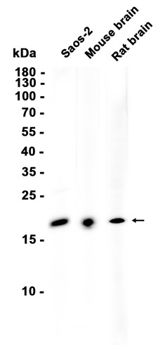 MYL12B (YD36171) Rabbit mAb