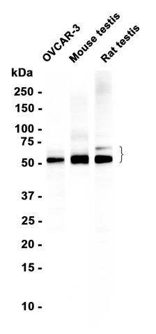 WT1 (YD35907) Rabbit mAb