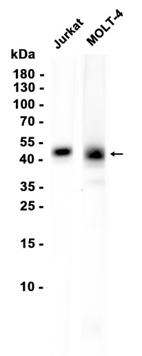 CD1D (YD20588) Rabbit mAb