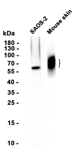 AYD14455