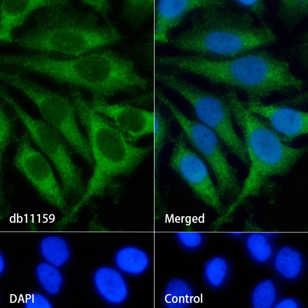Acetyl Coenzyme A carboxylase alpha (YD33624) Rabbit mAb