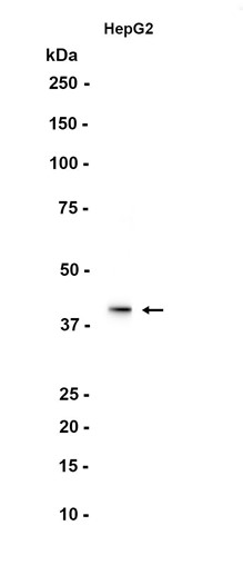 Erlin-2 (YD35916) Rabbit mAb