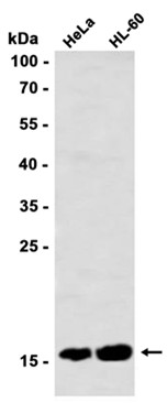 SFT (YD32561) Rabbit mAb