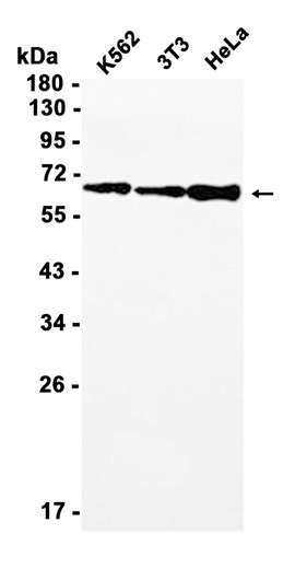 NF-KB p65 (YD14252) Rabbit mAb