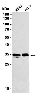AYD11627