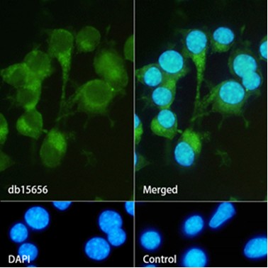 Ret (YD13116) Rabbit mAb