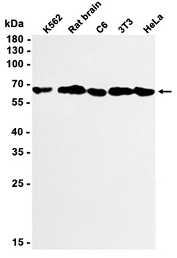 Beclin 1 (YD13564) Rabbit mAb