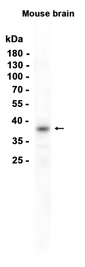 AYD11680