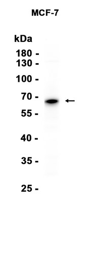AYD14385