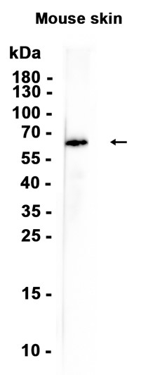 Cytokeratin 1 (YD32069) Rabbit mAb