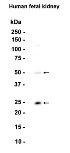 Sonic Hedgehog (YD14578) Rabbit mAb