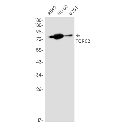 CREB Regulated Transcription Coactivator 2 (YD31742) Rabbit mAb