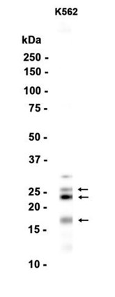AYD12799