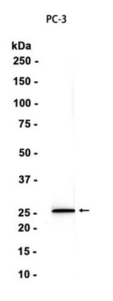AYD13722