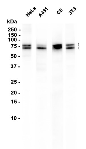 Cortactin (YD12765) Rabbit mAb