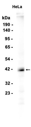 AYD14977