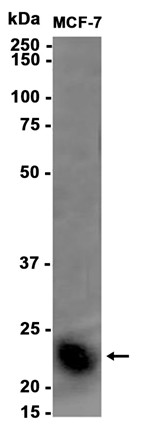 Tetranectin (YD13427) Rabbit mAb