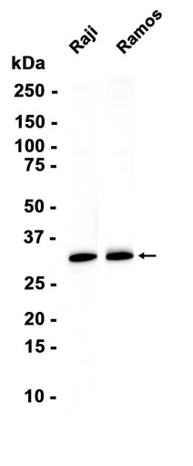 CD20 (YD35779) Mouse mAb