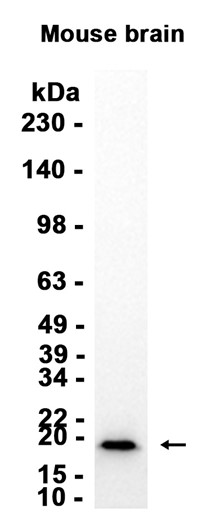 AYD13572