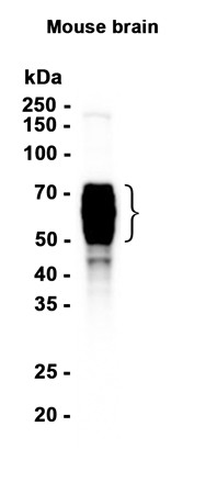 Phospho-Tau (Thr205) (YD14512) Rabbit mAb