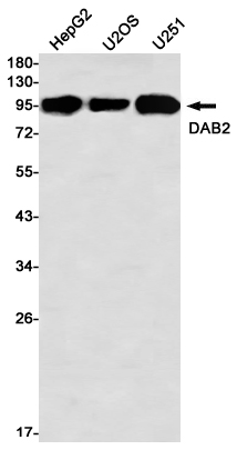 AYD11306