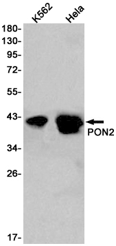 AYD11570
