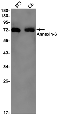 AYD11615