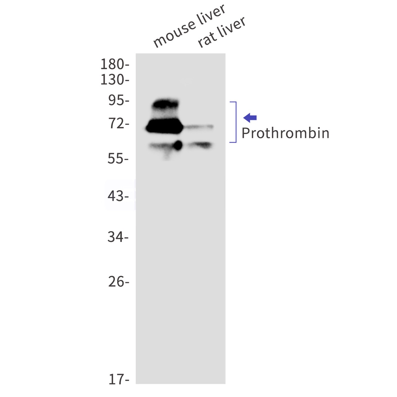 Prothrombin (YD14409) Rabbit mAb