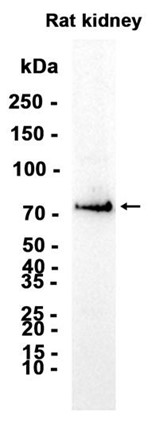 AYD14254