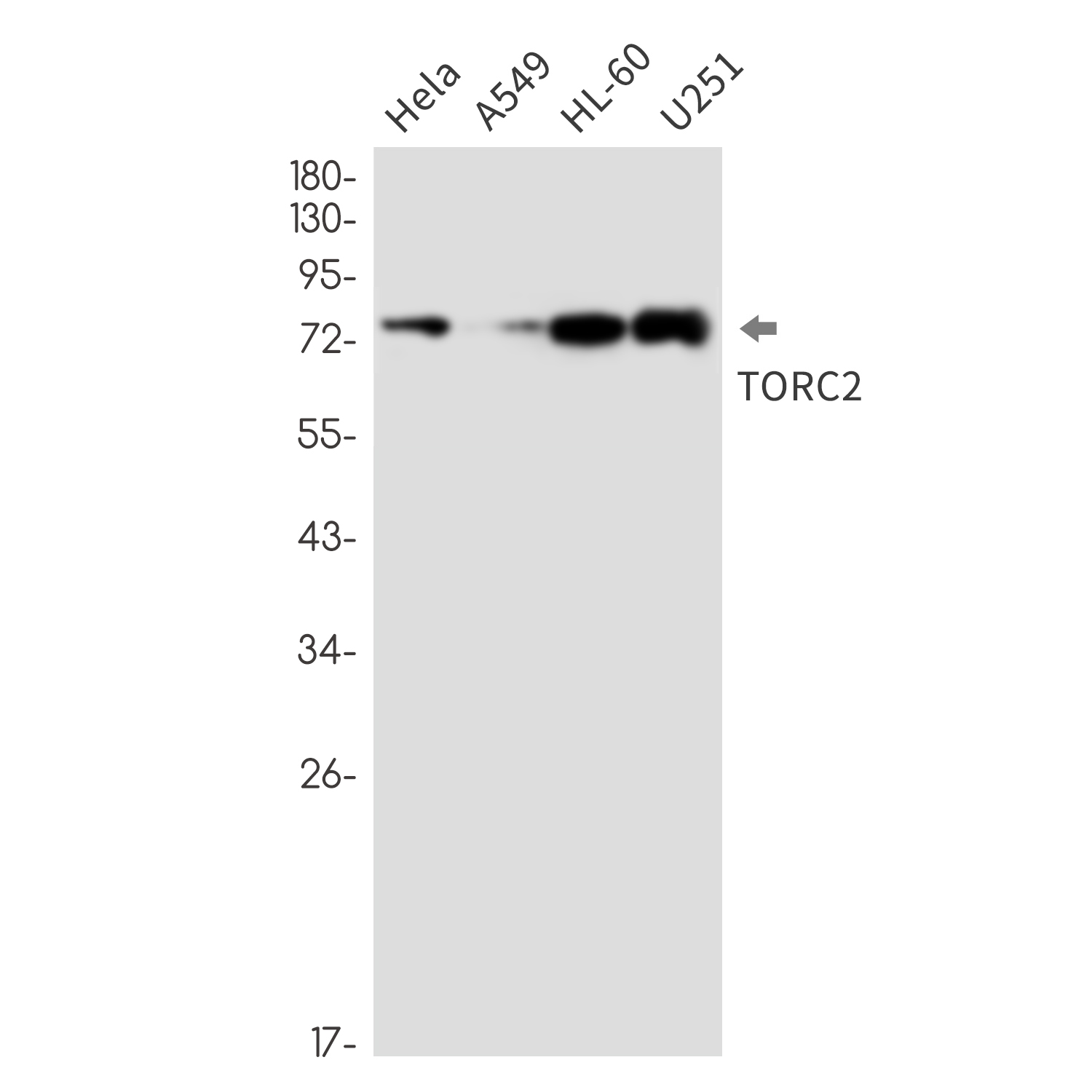 CREB Regulated Transcription Coactivator 2 (YD31164) Rabbit mAb