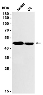 TGF beta 1 (YD12426) Rabbit mAb