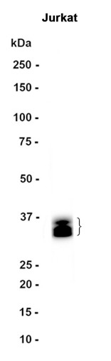 TRA2B (YD34629) Rabbit mAb