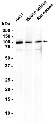 AYD16322