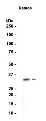 AYD12560