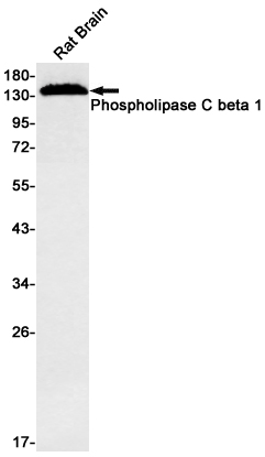 Phospholipase C beta 1 (YD12304) Rabbit mAb