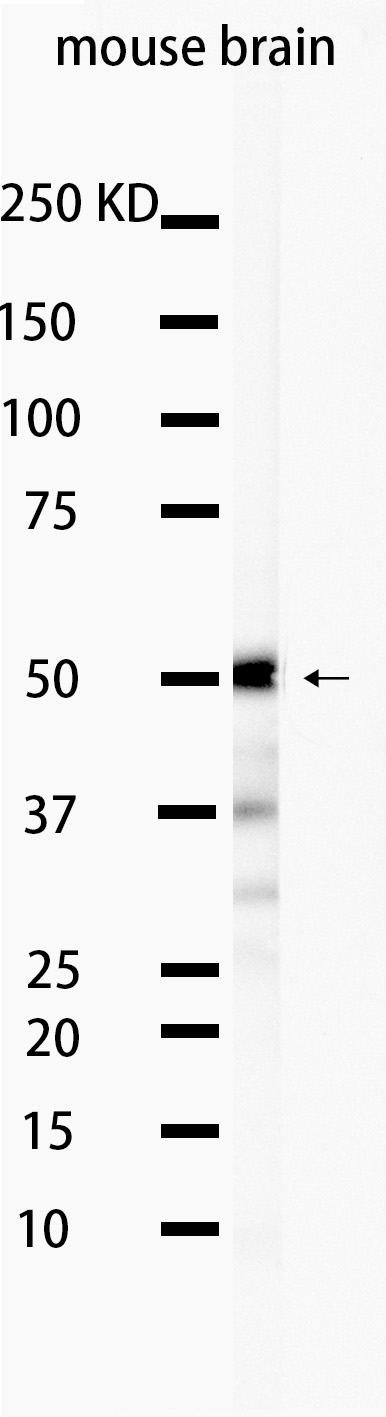 Tau 4R (YD15910) Rabbit mAb