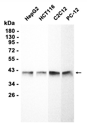 AYD11462