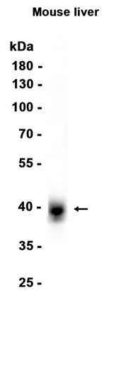 Liver Arginase (YD31292) Rabbit mAb