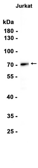 AYD15615